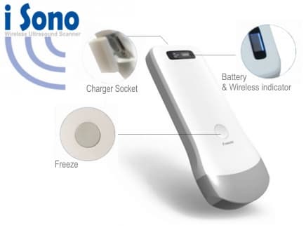 iSono wireless Ultrasound Scanner